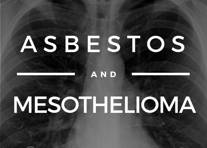 Asbestos & Mesothelioma: Know Your Rights